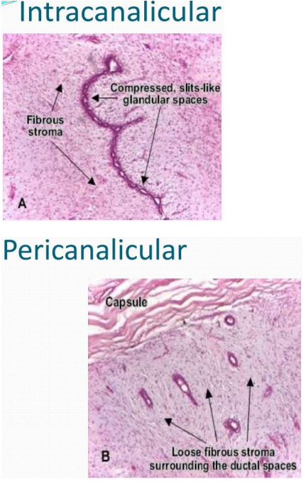 FAM_intracanalicular_pericanalicular.png